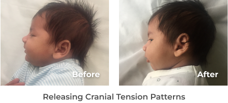 Releasing Cranial Tension Patterns 